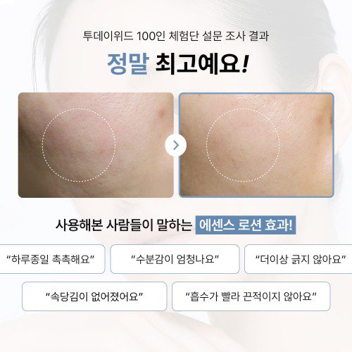 [투데이위드] 판테놀 5% 에센스로션 300ml, 1개